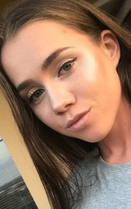 Patrície porazila akné!